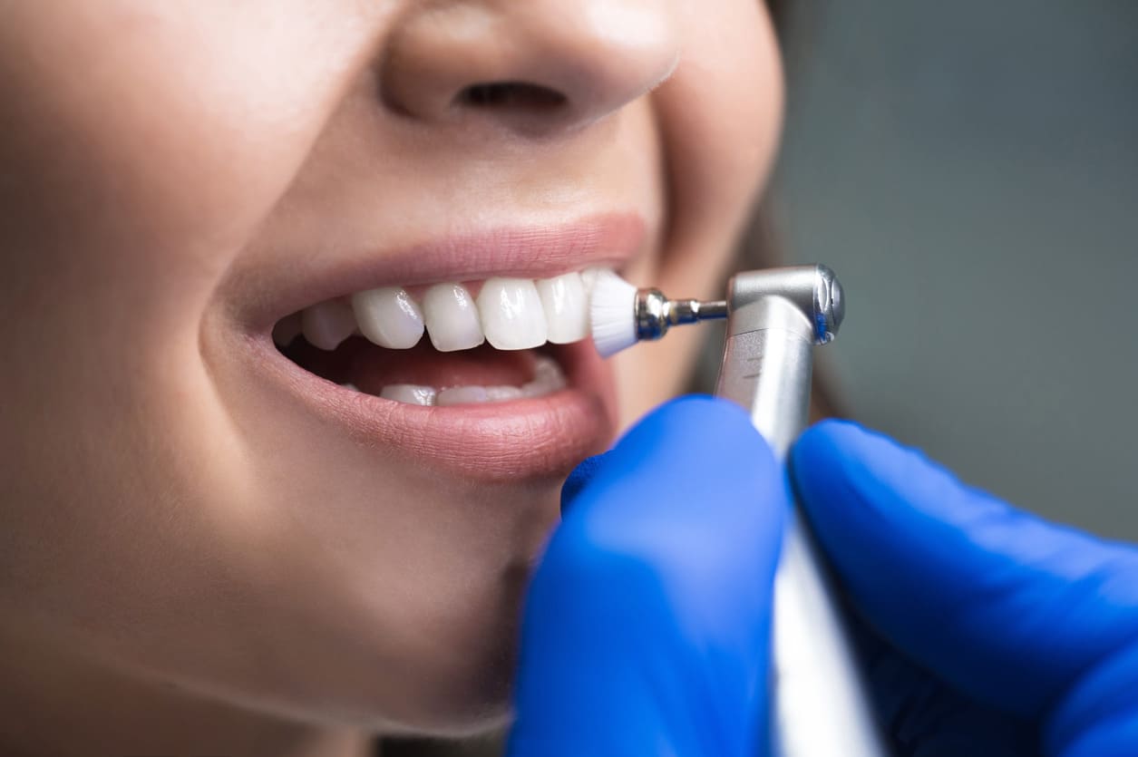 oral cleaning
