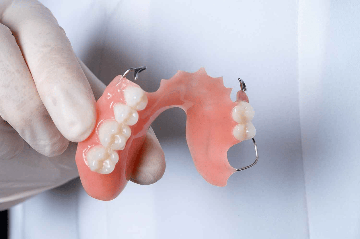partial denture